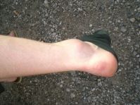 ouch!
Dateiname: 34343_1216291160873l.jpg