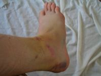 noch mehr ouch!
Dateiname: 34343_1216291517840l.jpg