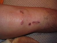 knie
Dateiname: P1151944.JPG