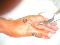 daumen links
Dateiname: PICT0001.JPG